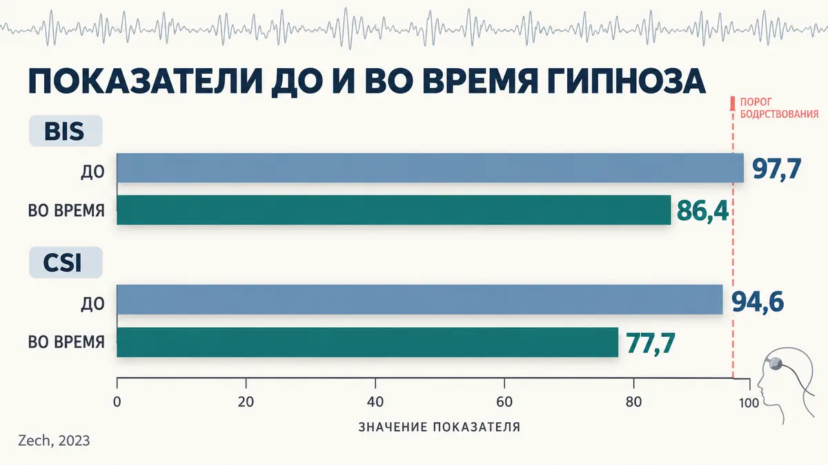 глубина гипнотического транса и приборы: индексы BIS и CSI до и во время гипноза